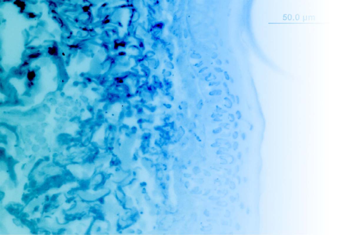 skinpt-structure-of-healthy-skin